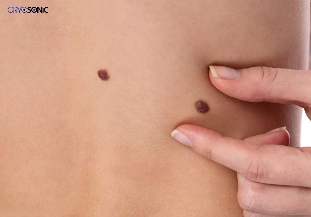 Infection Risk and Poor Aftercare Eastbourne