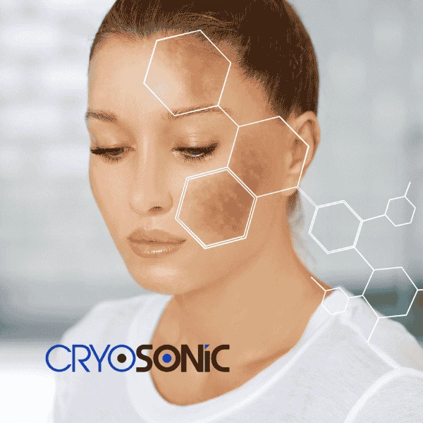 Are you looking for age spot removal treatment? Contact Cryosonic today in Eastbourne
