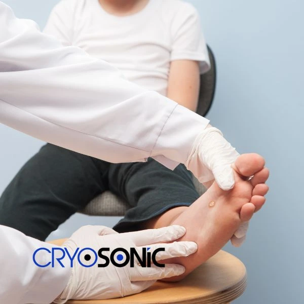 Are you looking for fast effective wart removal Contact us today Eastbourne